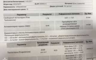 АМГ 0,8 . ФСГ 12.7—-пытаться или сдаваться????