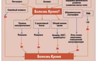 Диагностика болезни Крона