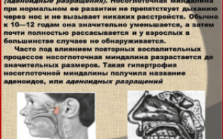 Гипертрофия носоглоточной миндалины (аденоиды)