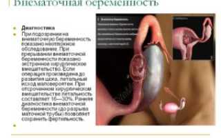 можно ли беременеть через 2 месяца после внематочной?