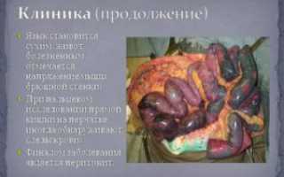 Эмболия и тромбоз мезентериальных сосудов