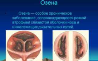 Озена