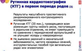 Особенности интерпретации данных КТГ в первом периоде родов