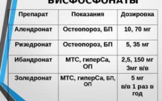 Выбор лекарства от остеопороза
