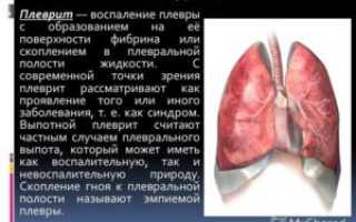 Воспалительные заболевания плевры