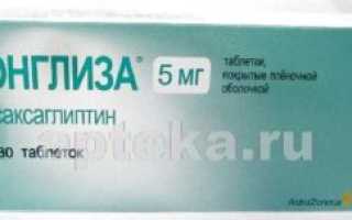ик и сиофор или онглиза