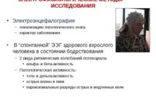Электрофизиологические методы исследования (ЭФИ)